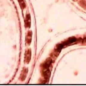 thumbnail for publication: Common Freshwater Fish Parasites Pictorial Guide: Nematodes